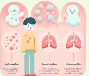 Aspergilose pulmonar