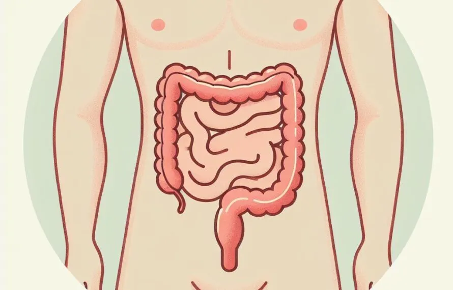 Diverticulite Diverticulite