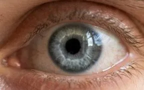 Glaucoma pode ser tratado sem começar pelos colírios? Laser SLT amplia alternativas para pacientes em São Paulo
